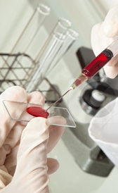 HEMATOCRITO BAJOS hematocrito bajos: